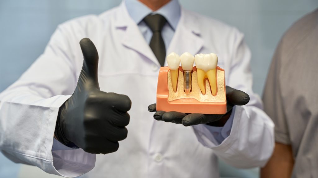 Am I a Candidate for Implants