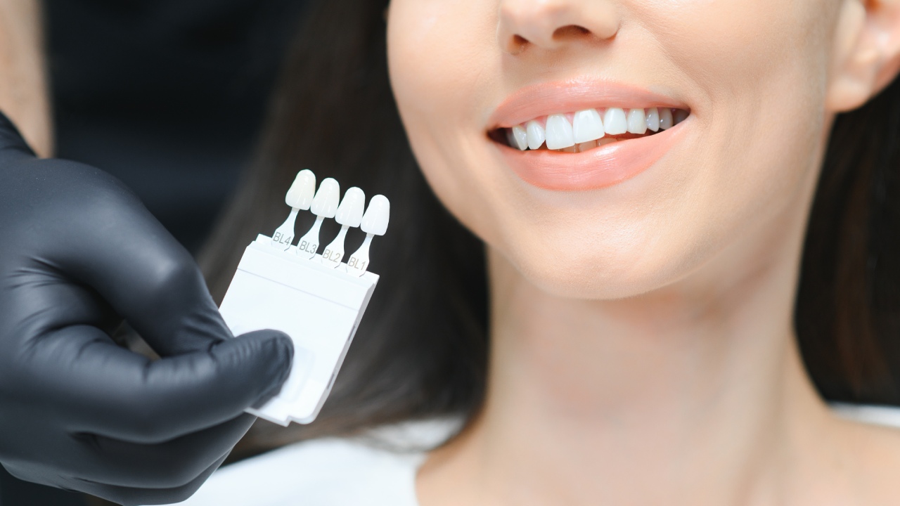 Are Veneers Right for You