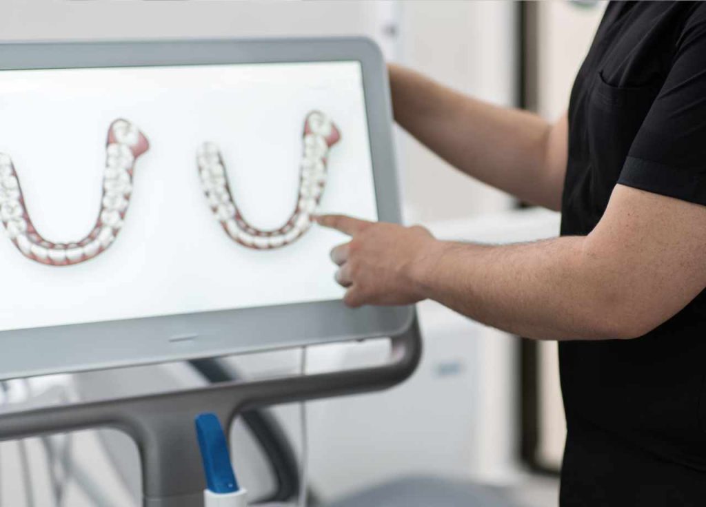 Who Benefits Most from iTero Digital Scanning?