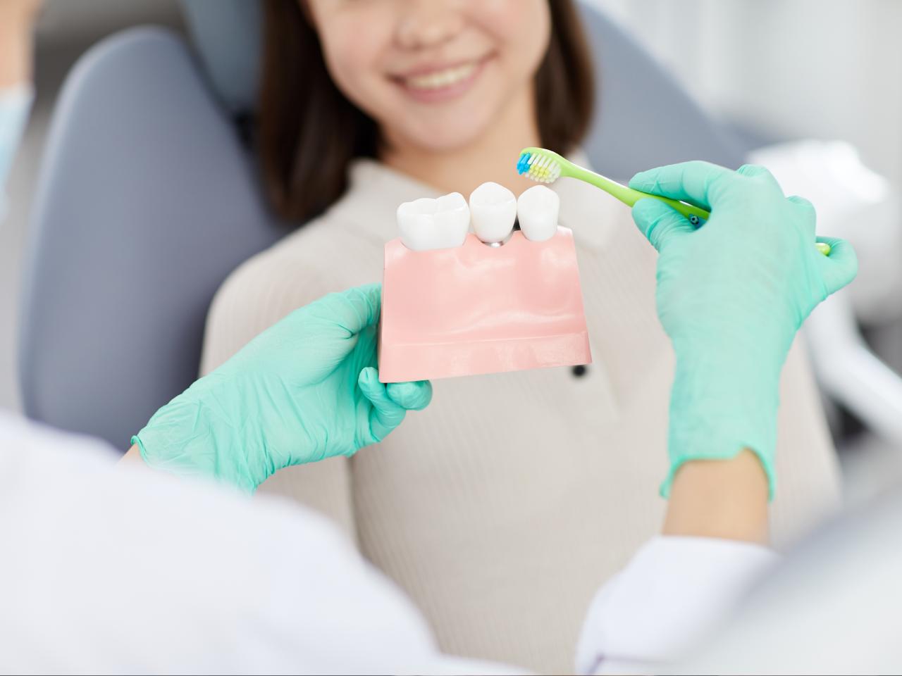 Dental Crowns & Bridges