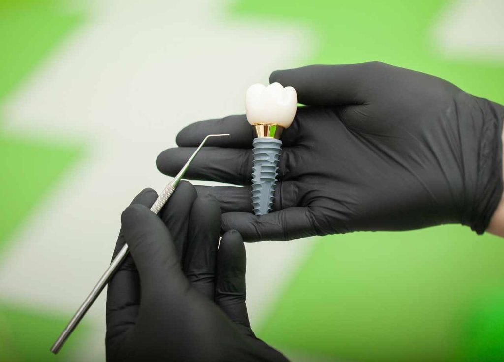 Dental Implant Cost & Payment Options