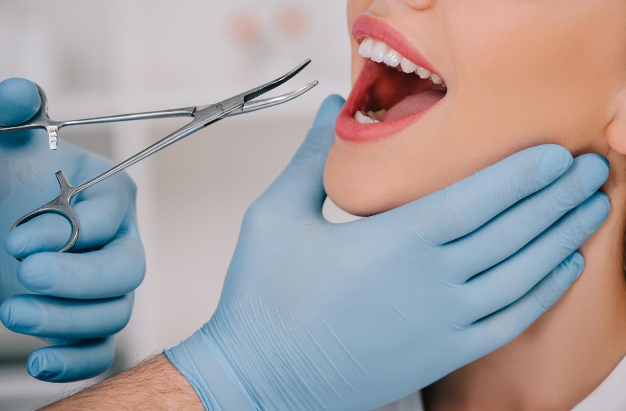 Protecting Your Smile After an Extraction