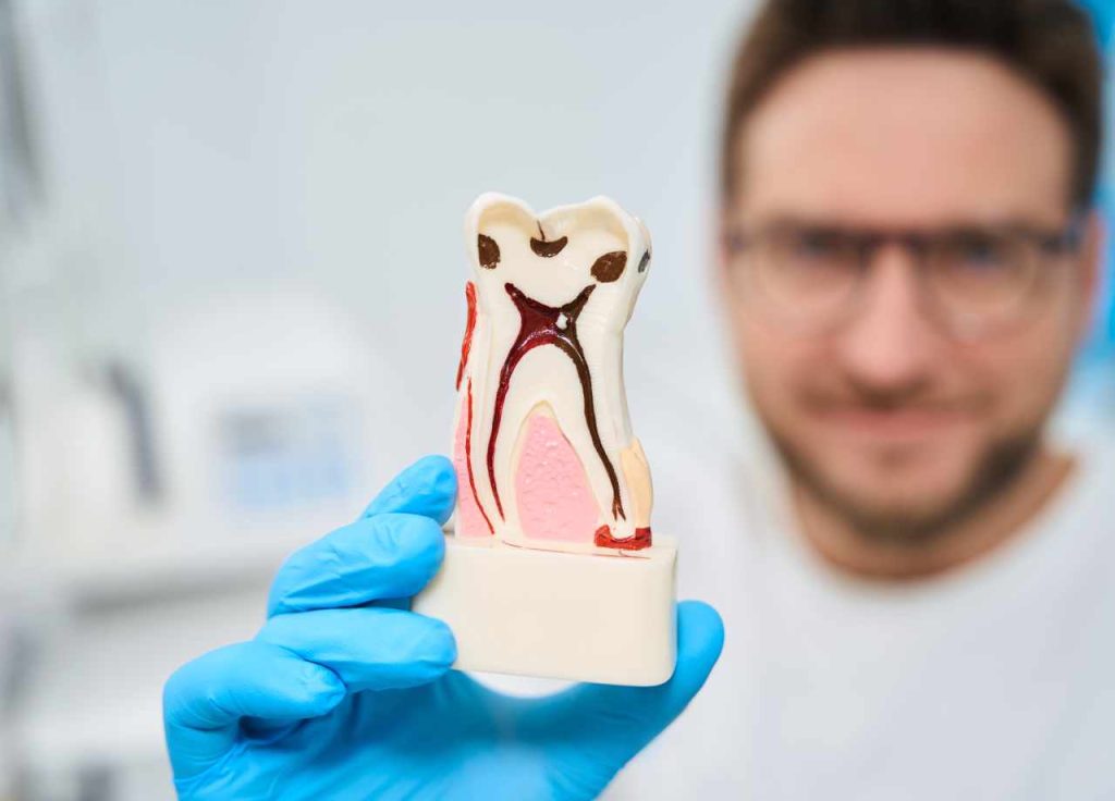 What Happens if You Avoid a Needed Root Canal_