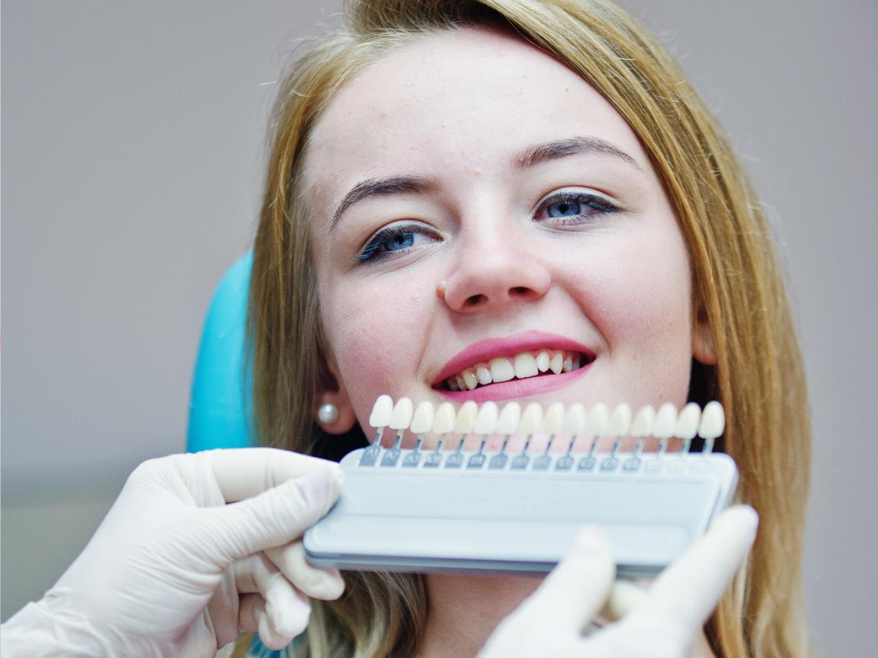 Why Cherryville Chooses Cloninger Dentistry for Veneers