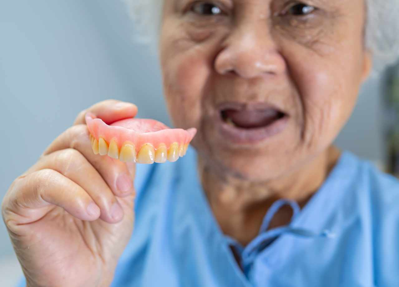 Benefits of Custom Dentures